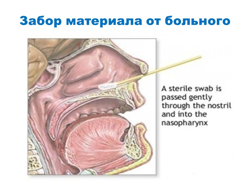 Забор материала от больного